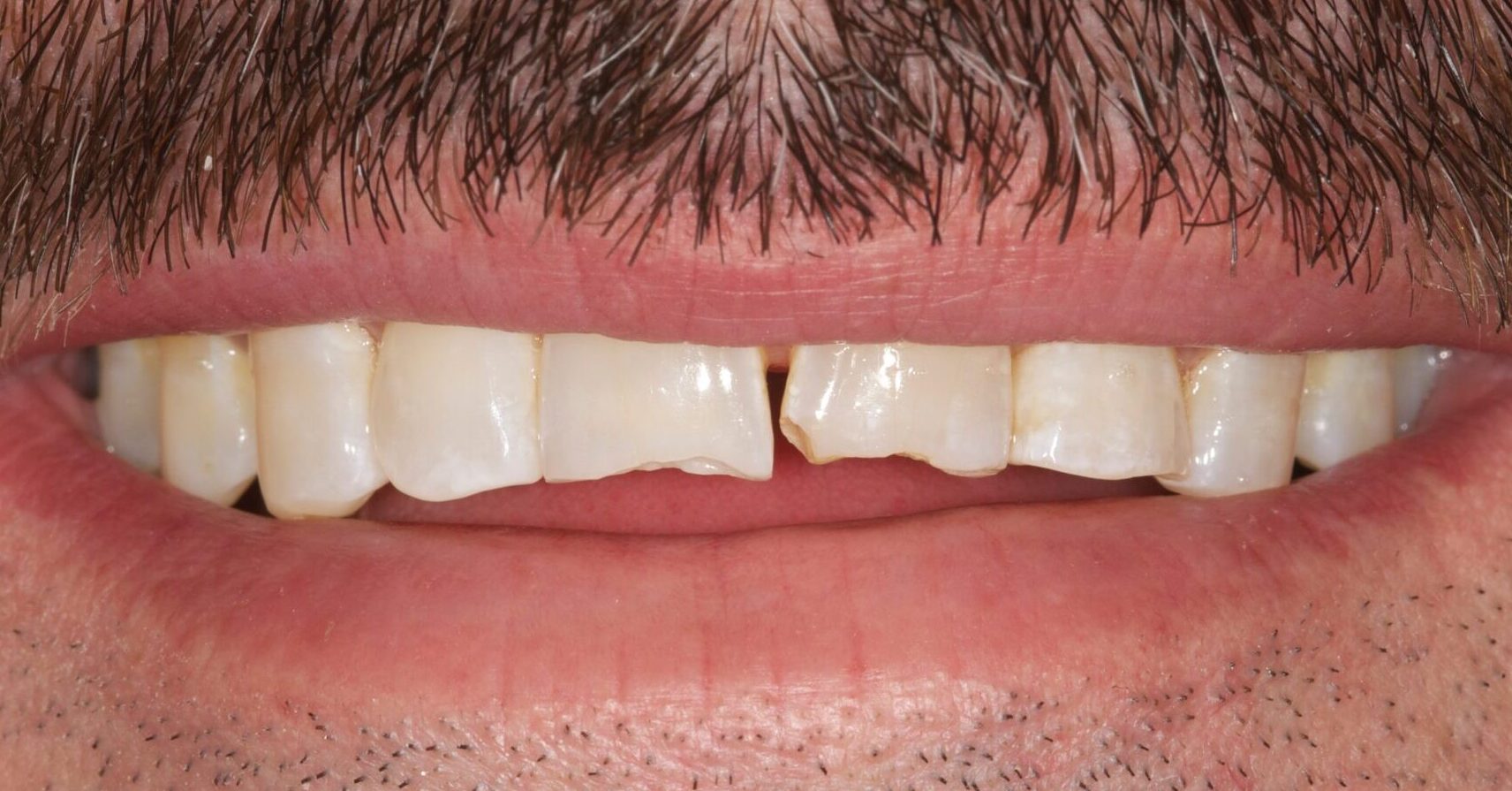 2de3f28b-517d-4d35-b68c-0700c30eb0d4-0-2before___after_photos-DSC_0008