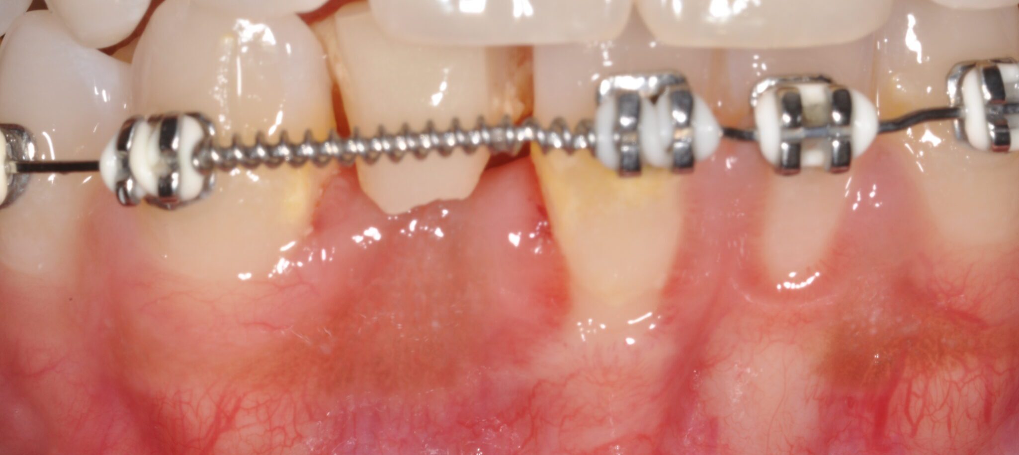 2de3f28b-517d-4d35-b68c-0700c30eb0d4-0-2before___after_photos-DSC_0036