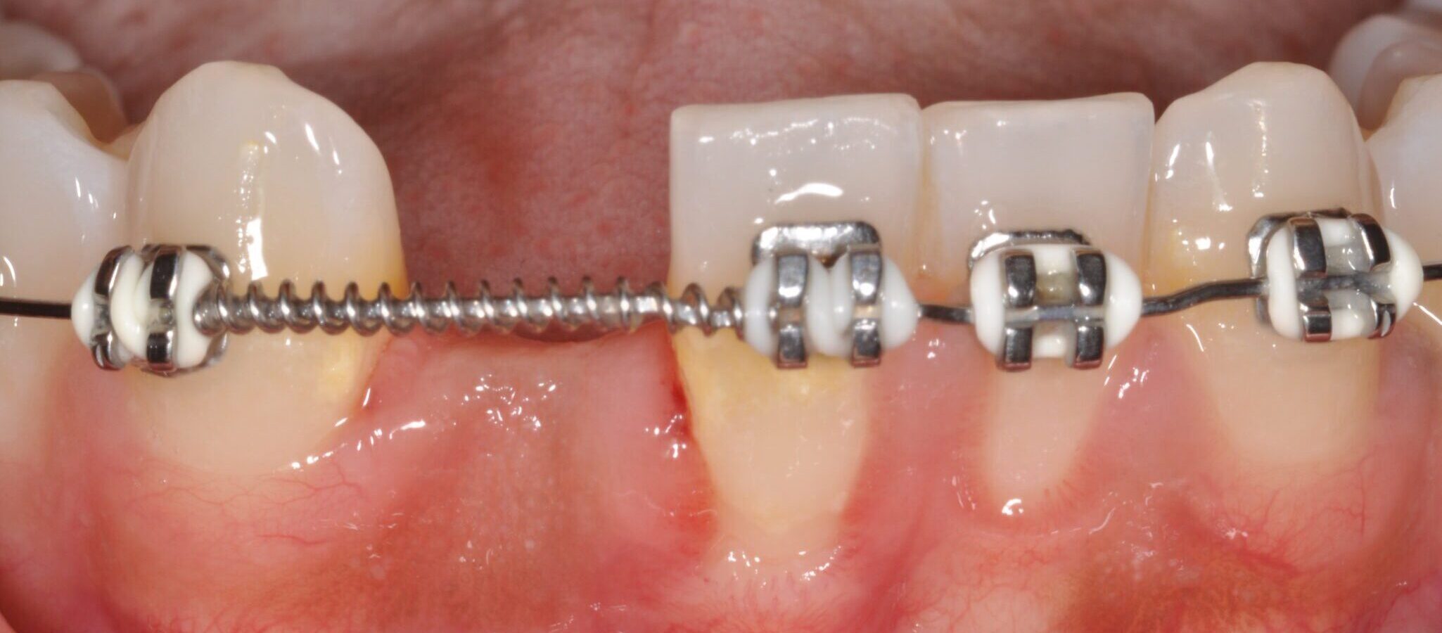 2de3f28b-517d-4d35-b68c-0700c30eb0d4-0-2before___after_photos-DSC_0037