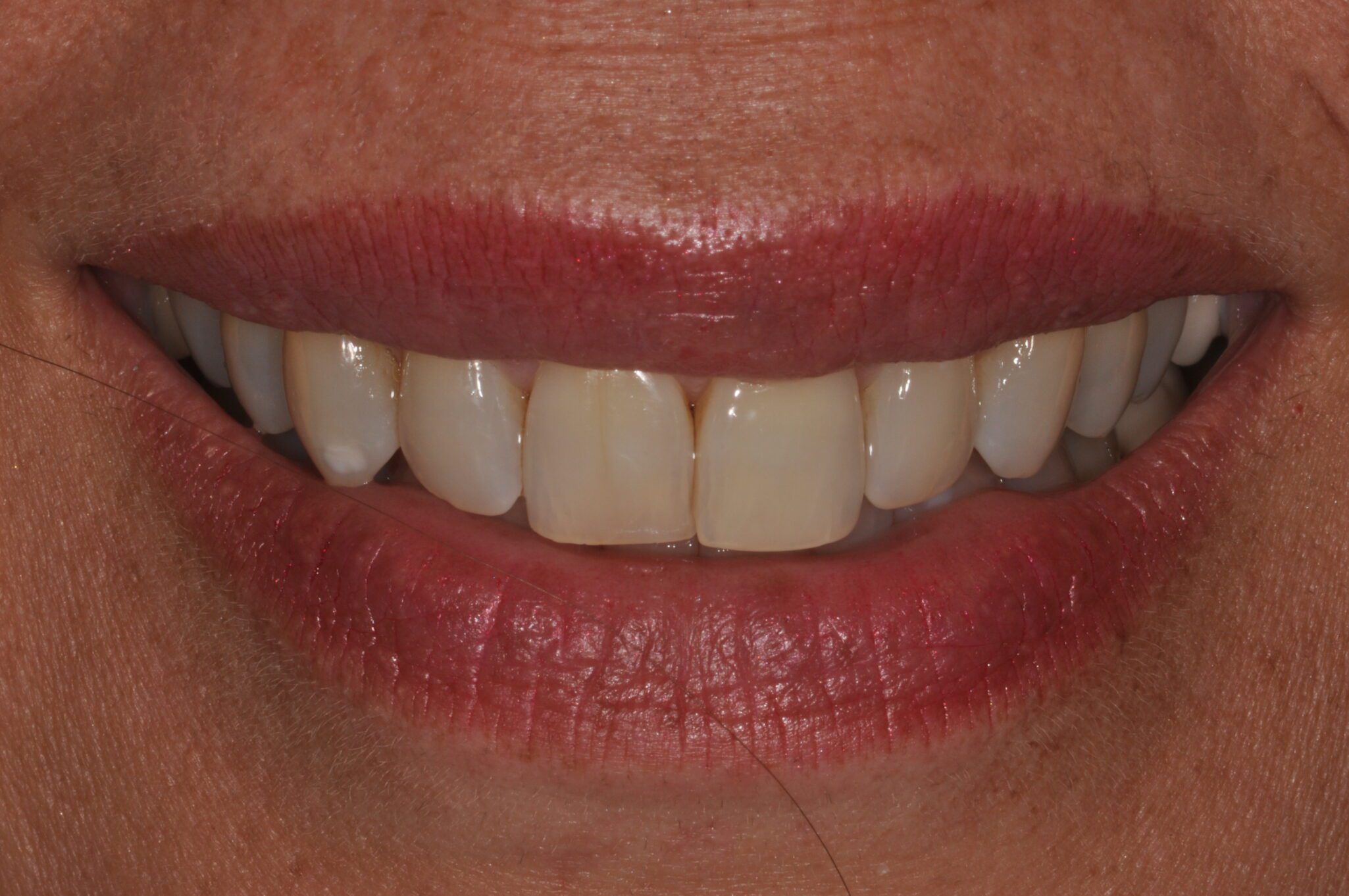 2de3f28b-517d-4d35-b68c-0700c30eb0d4-0-2before___after_photos-DSC_0045