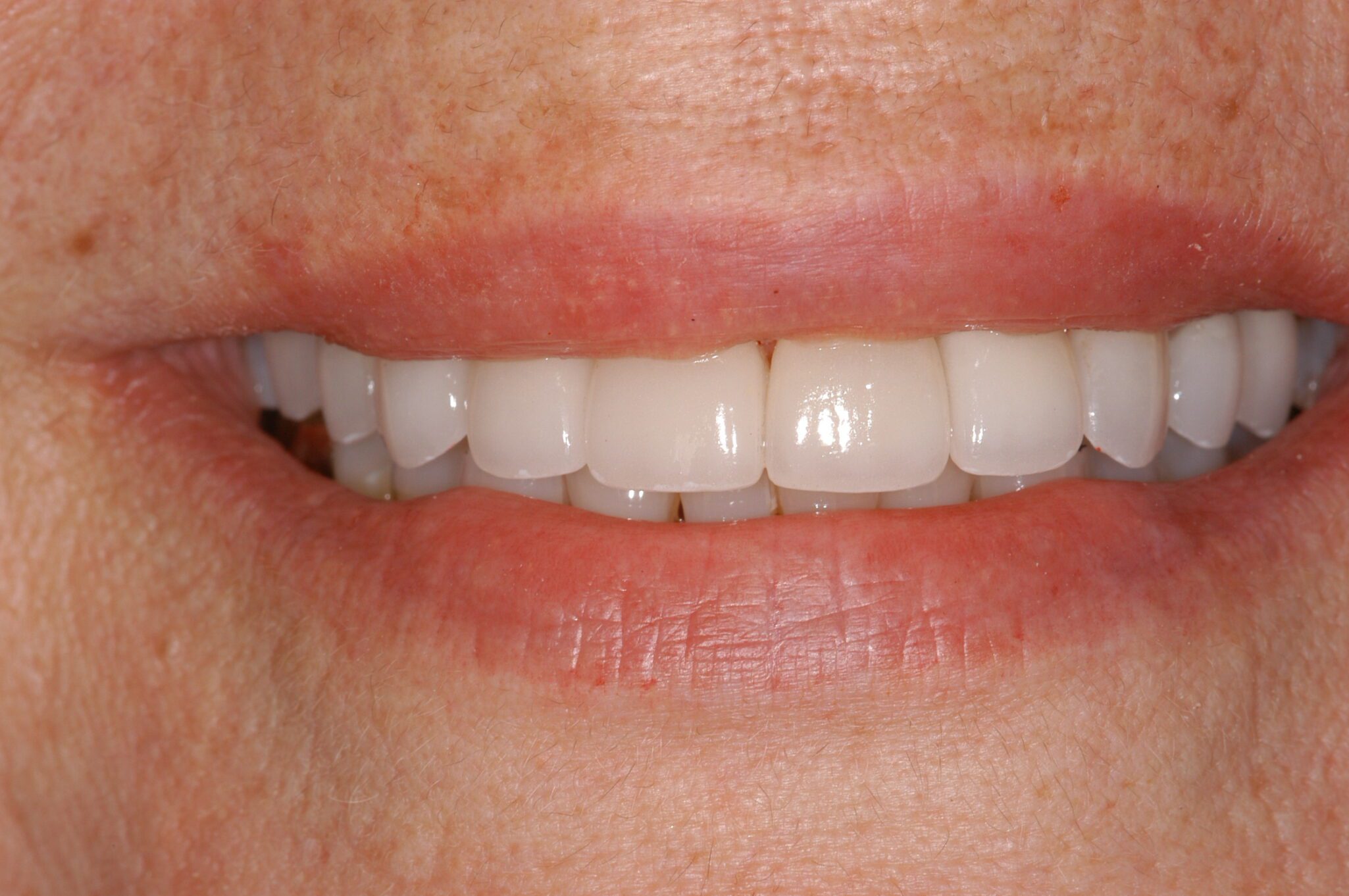 2de3f28b-517d-4d35-b68c-0700c30eb0d4-0-2before___after_photos-Odette-Johnson-post-(1)