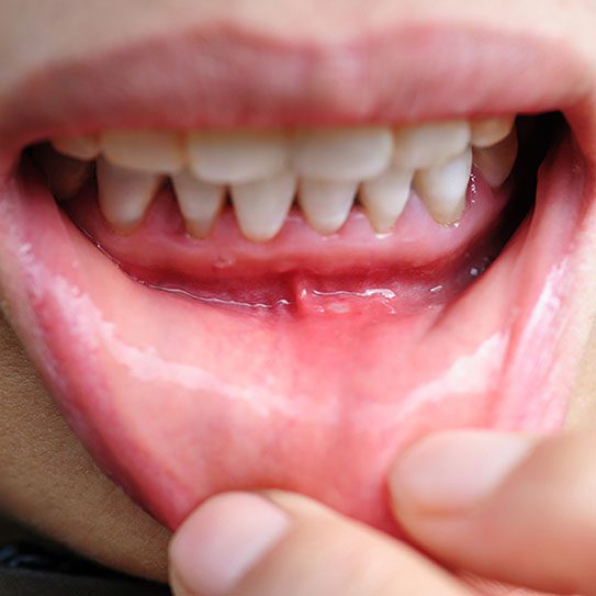 Dentist in Glendora CA